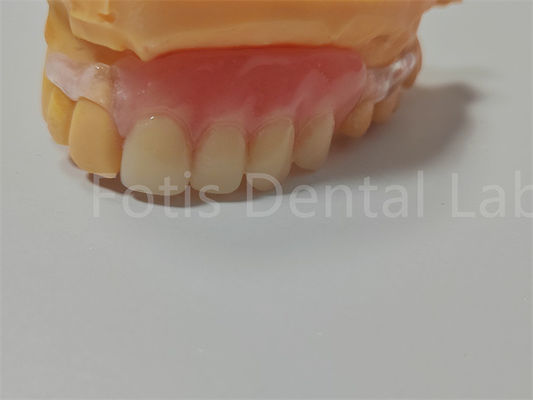 Πιστοποίηση FDA / ISO TCS Valplast Ευέλικτες οδοντοστοιχίες εύκολο στο καθαρισμό προσαρμόζεται
