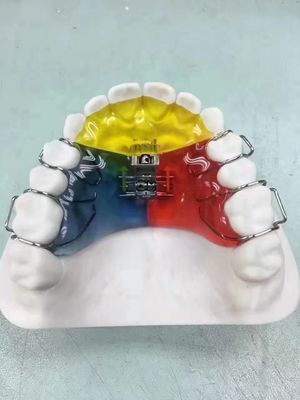 Nance / Hyrax / Rapid Palatal Expander Νυχτερινός Φύλακας Διαστήματος Φύλακας OEM Ασφαλής Χρήσης
